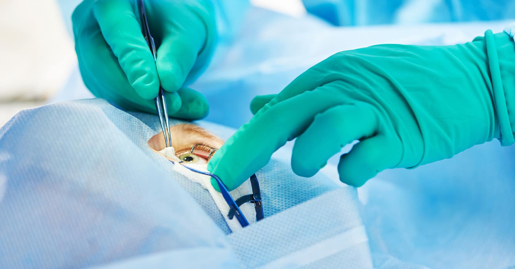 Chirurgie cataracte : chirurgien ophtalmologue | Opération cataracte à ...