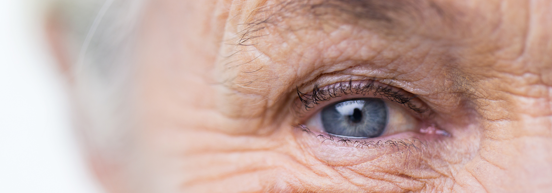 Dégénérescence maculaire