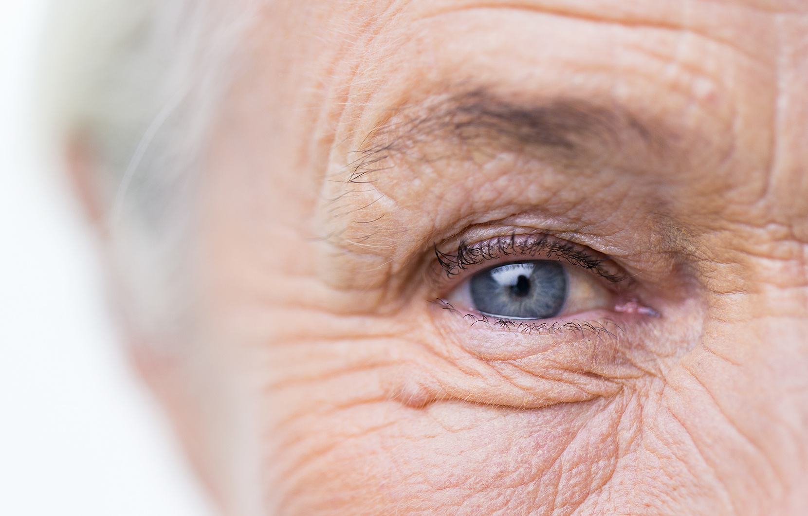 Dégénérescence maculaire