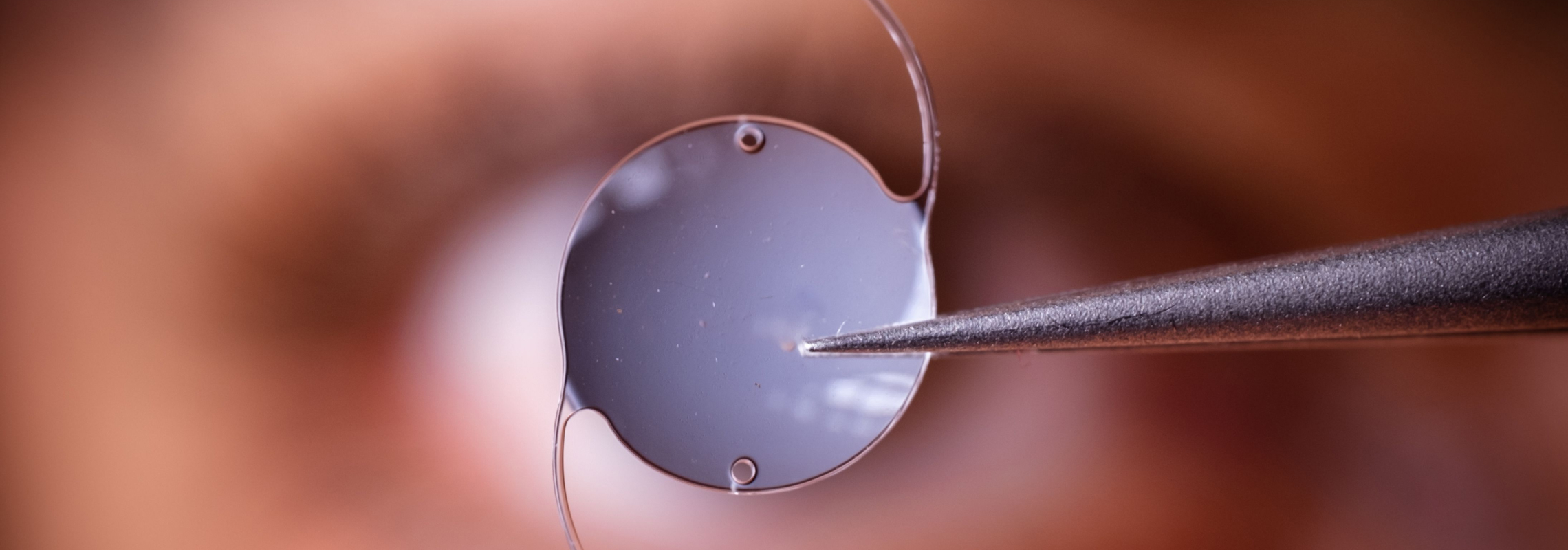 Implants cataracte | Dr Berthon | Lyon