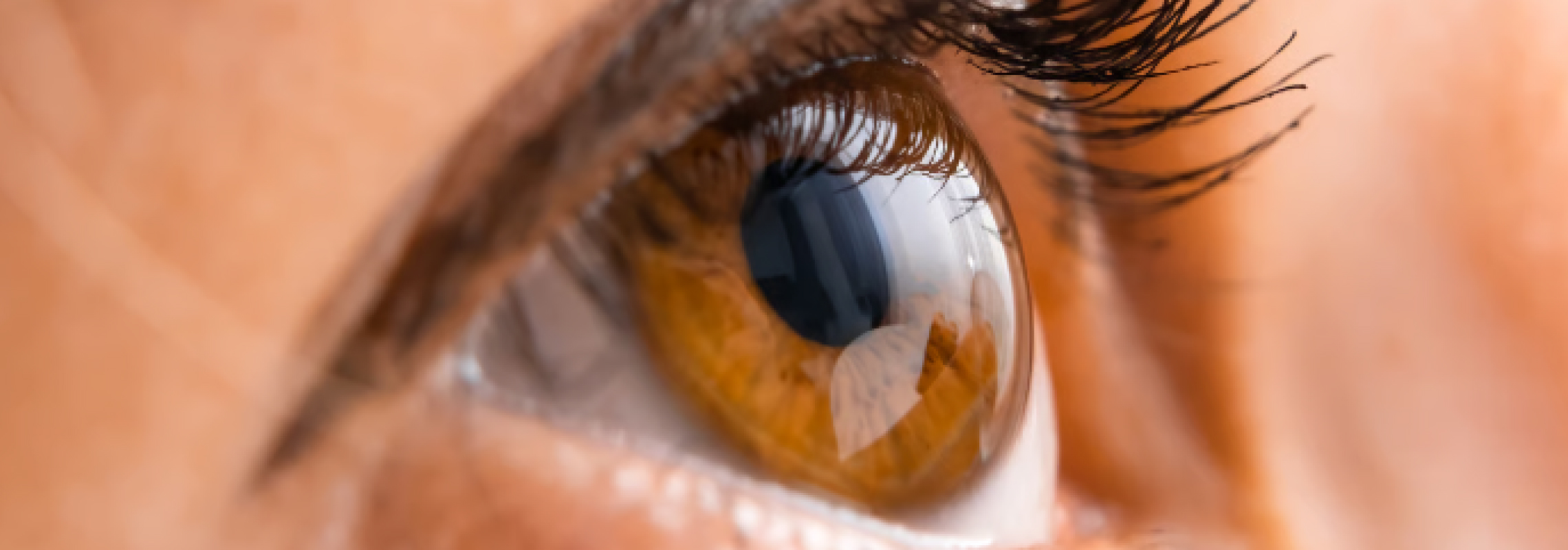 Vision floue après cataracte : œdème maculaire | Dr Berthon | Lyon