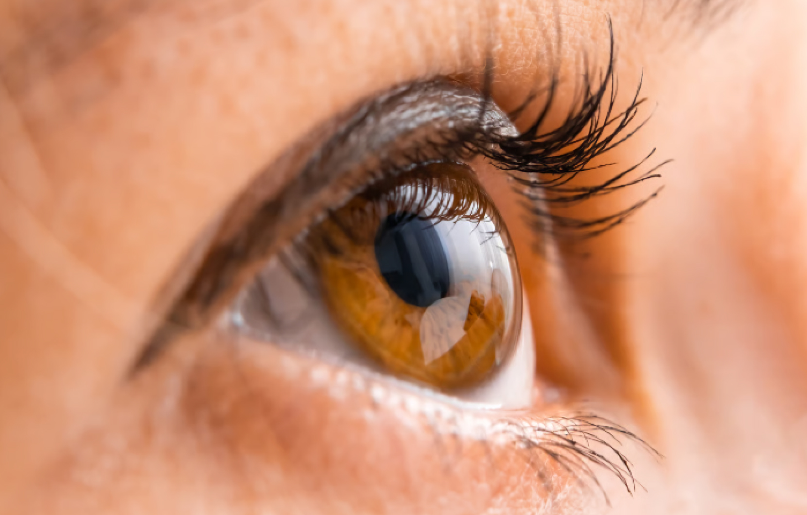 Vision floue après cataracte : œdème maculaire | Dr Berthon | Lyon